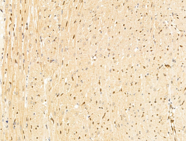 TFAP4 Antibody in Immunohistochemistry (Paraffin) (IHC (P))