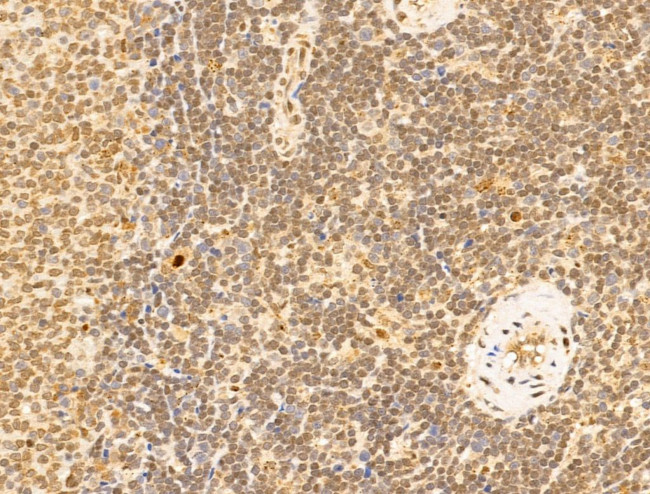 TFAP4 Antibody in Immunohistochemistry (Paraffin) (IHC (P))