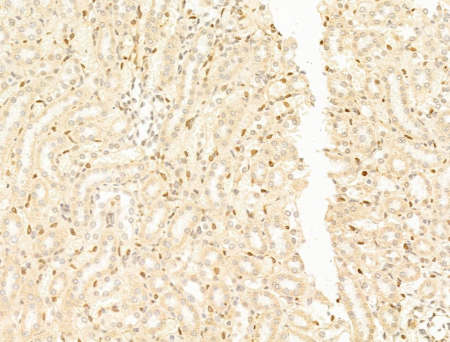 TFAP4 Antibody in Immunohistochemistry (Paraffin) (IHC (P))