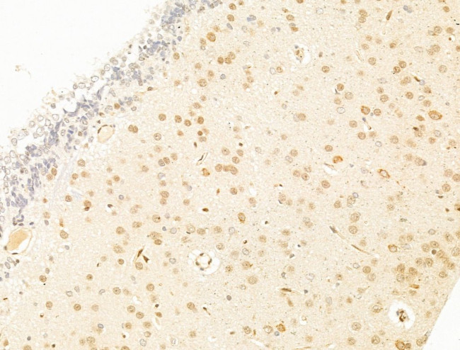 TFAP4 Antibody in Immunohistochemistry (Paraffin) (IHC (P))