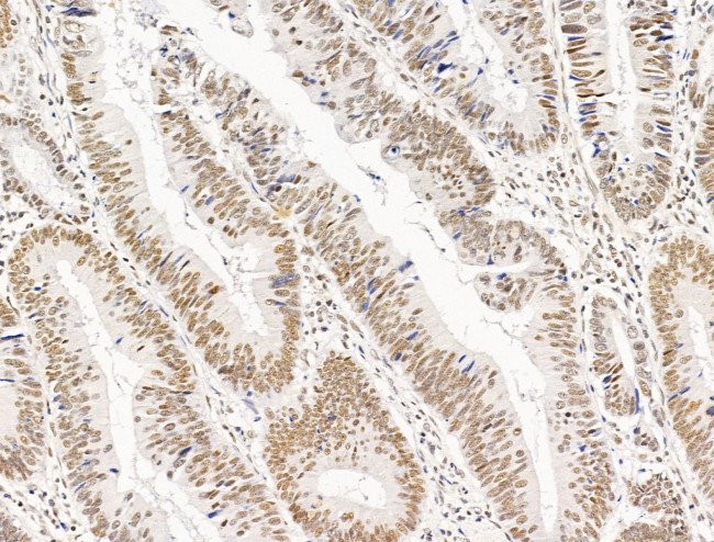 TFAP4 Antibody in Immunohistochemistry (Paraffin) (IHC (P))