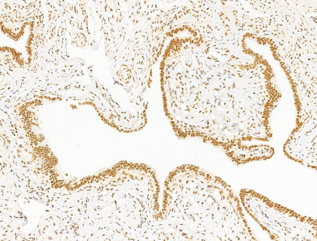 TFAP4 Antibody in Immunohistochemistry (Paraffin) (IHC (P))