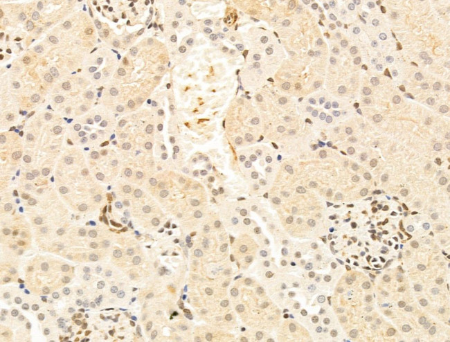 TFAP4 Antibody in Immunohistochemistry (Paraffin) (IHC (P))