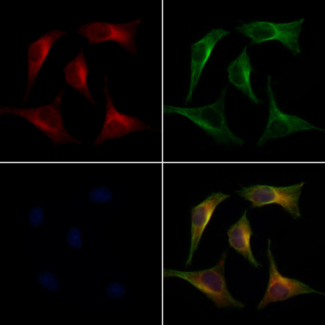 TGFBI Antibody in Immunocytochemistry (ICC/IF)