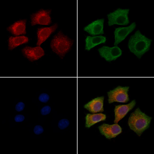 CD202b (TIE2) Antibody in Immunocytochemistry (ICC/IF)