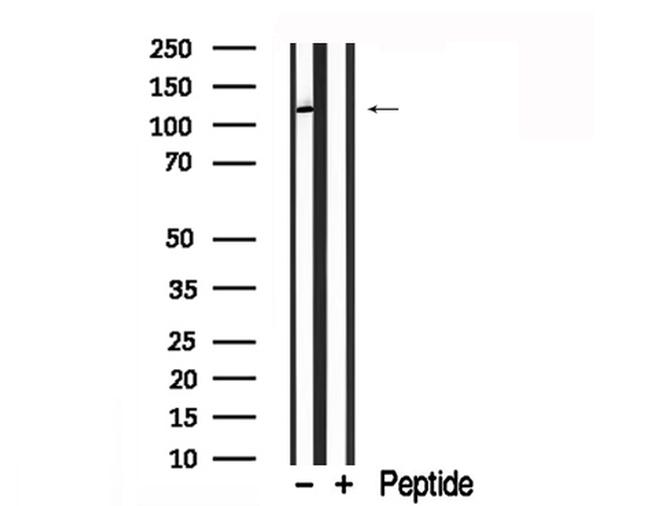 CD202b (TIE2) Antibody in Western Blot (WB)