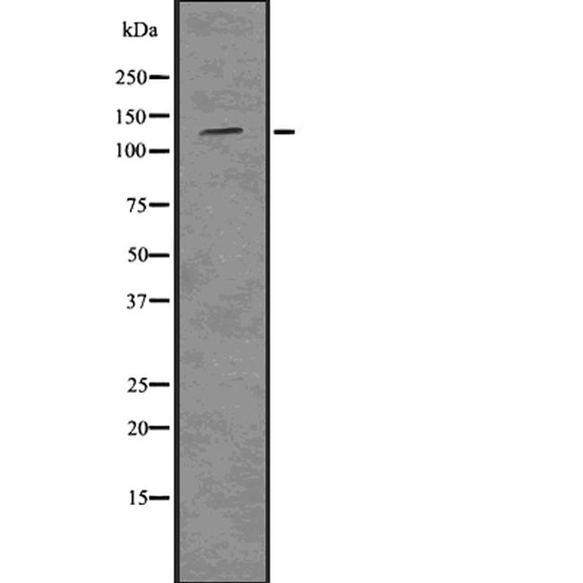 CD202b (TIE2) Antibody in Western Blot (WB)