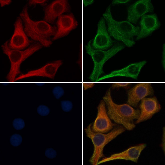 CD202b (TIE2) Antibody in Immunocytochemistry (ICC/IF)