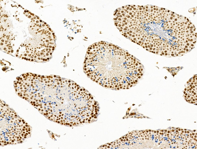 TIM-4 Antibody in Immunohistochemistry (Paraffin) (IHC (P))