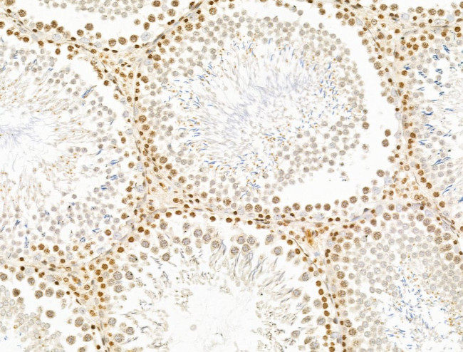 TIM-4 Antibody in Immunohistochemistry (Paraffin) (IHC (P))