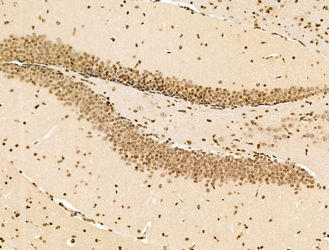 TIM-4 Antibody in Immunohistochemistry (Paraffin) (IHC (P))