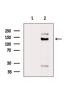 TIMELESS Antibody in Western Blot (WB)