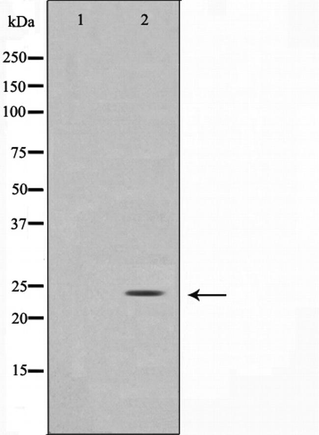 TIMP3 Antibody in Western Blot (WB)