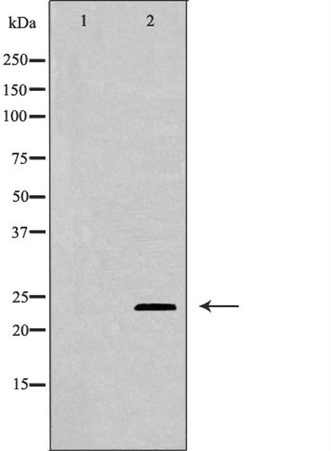 TIMP3 Antibody in Western Blot (WB)