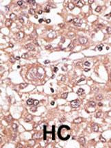 TLR7 Antibody in Immunohistochemistry (Paraffin) (IHC (P))