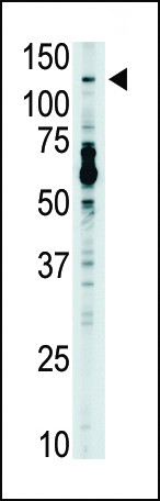 TLR7 Antibody in Western Blot (WB)