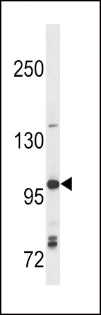 TLR7 Antibody in Western Blot (WB)