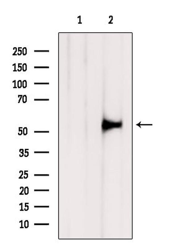 TMPRSS2 Antibody in Western Blot (WB)