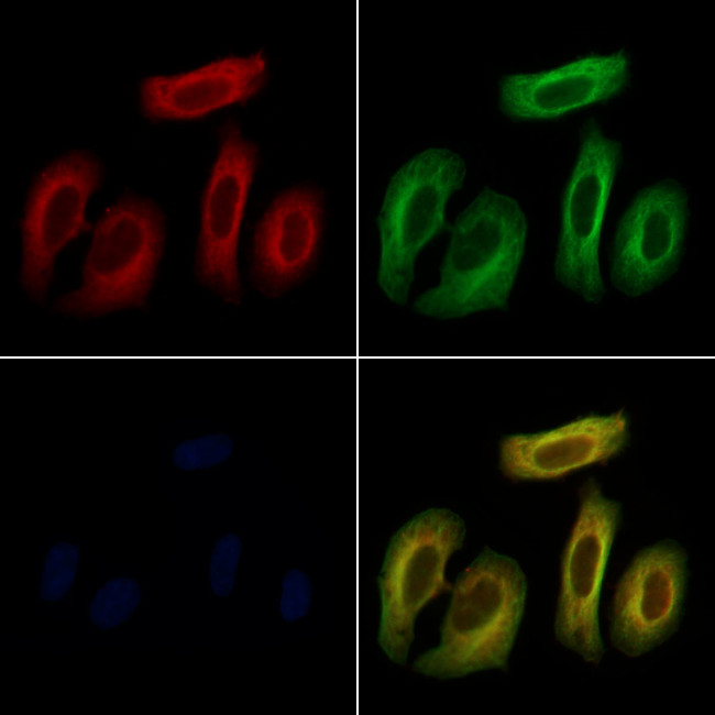 TNF beta Antibody in Immunocytochemistry (ICC/IF)