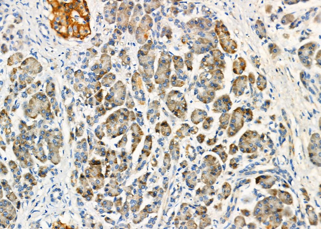 TNF beta Antibody in Immunohistochemistry (Paraffin) (IHC (P))