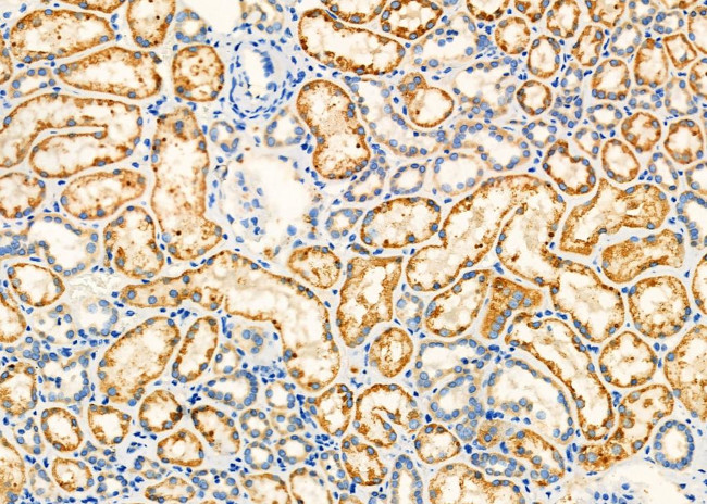 TNF beta Antibody in Immunohistochemistry (Paraffin) (IHC (P))