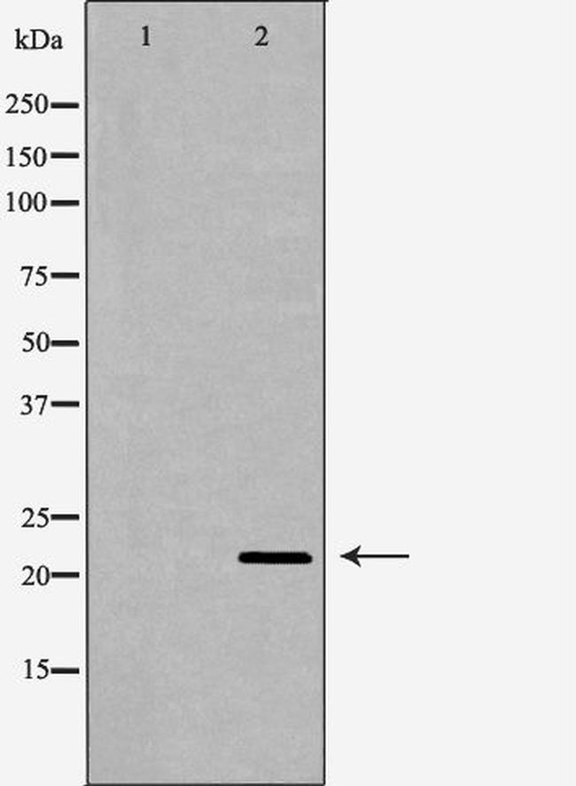 TNF beta Antibody in Western Blot (WB)