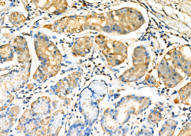 TNFRSF14 Antibody in Immunohistochemistry (Paraffin) (IHC (P))