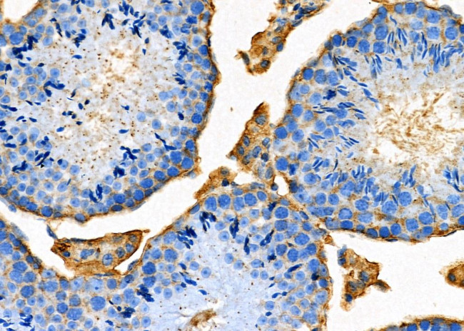 OX40L Antibody in Immunohistochemistry (Paraffin) (IHC (P))