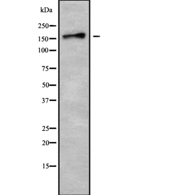 TNIK Antibody in Western Blot (WB)