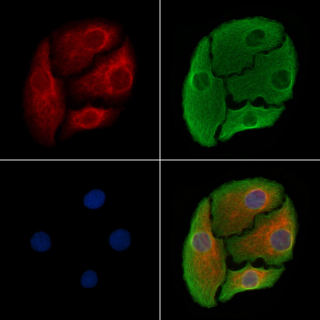 5T4 Antibody in Immunocytochemistry (ICC/IF)