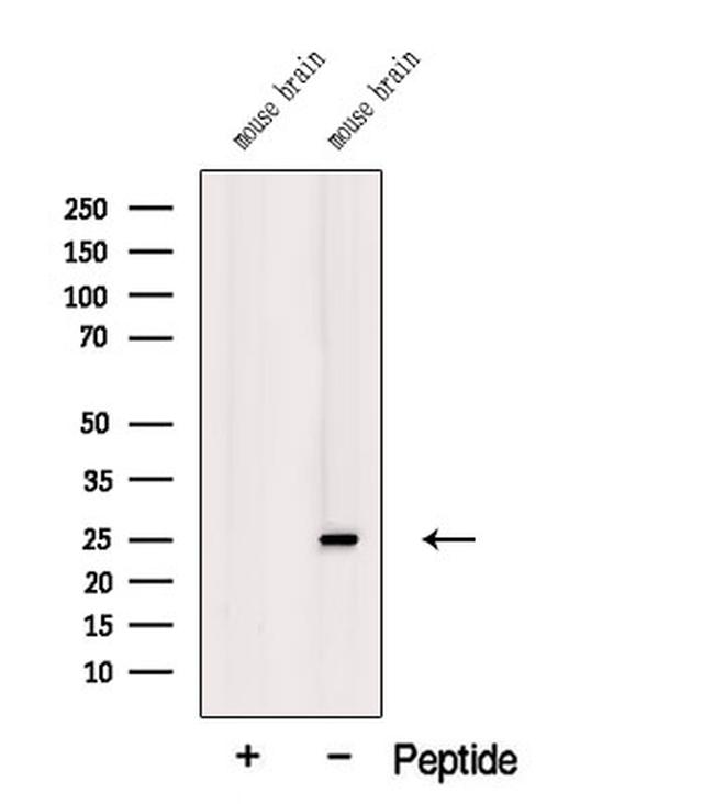 TREM2 Antibody in Western Blot (WB)