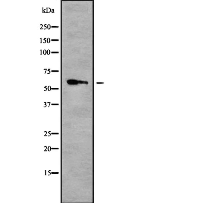 TRF2 Antibody in Western Blot (WB)