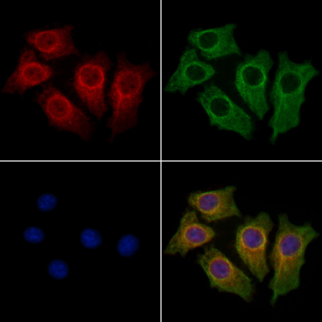 TCHH Antibody in Immunocytochemistry (ICC/IF)