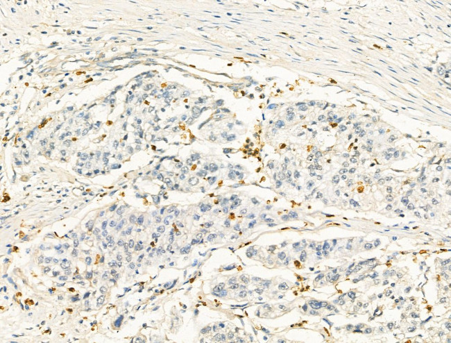 ZFP36 Antibody in Immunohistochemistry (Paraffin) (IHC (P))