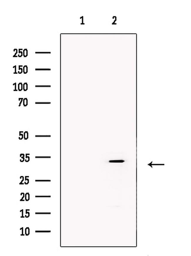 ZFP36 Antibody in Western Blot (WB)