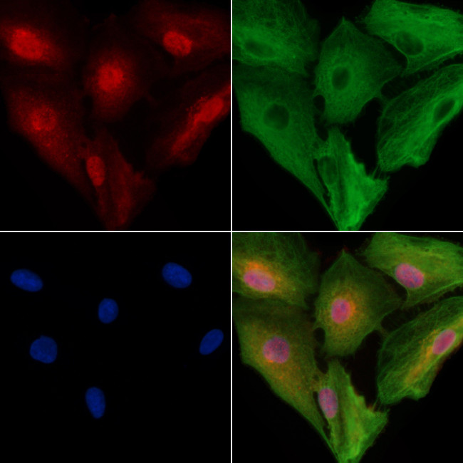 TROY Antibody in Immunocytochemistry (ICC/IF)