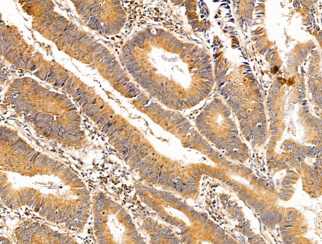 TROY Antibody in Immunohistochemistry (Paraffin) (IHC (P))