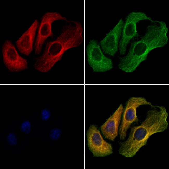 TRPC3 Antibody in Immunocytochemistry (ICC/IF)