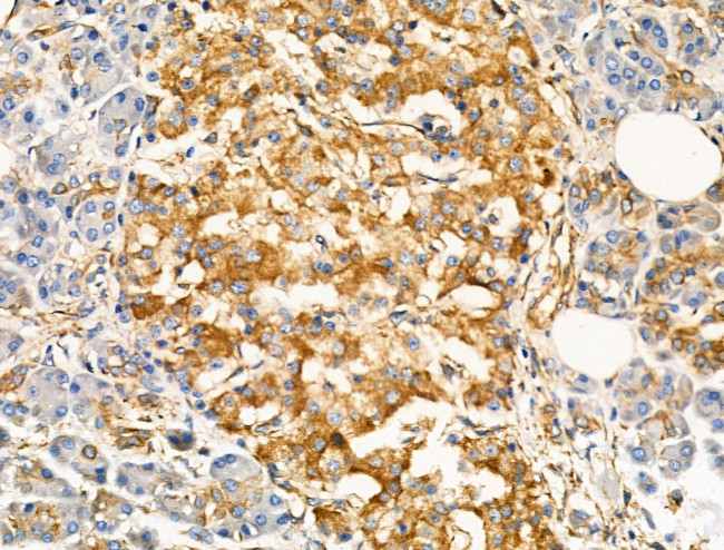 TRPC3 Antibody in Immunohistochemistry (Paraffin) (IHC (P))