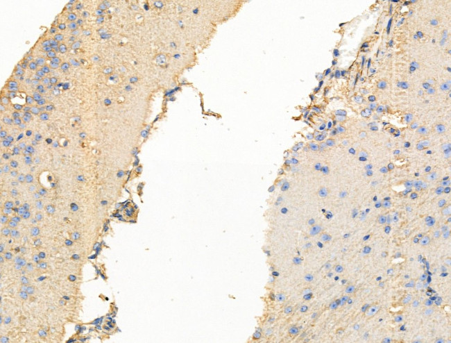 TRPC3 Antibody in Immunohistochemistry (Paraffin) (IHC (P))