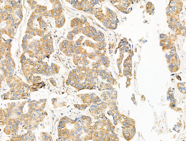 TRPC3 Antibody in Immunohistochemistry (Paraffin) (IHC (P))