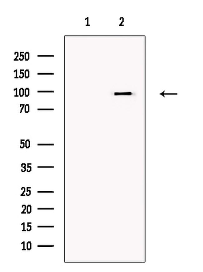 TRPC3 Antibody in Western Blot (WB)