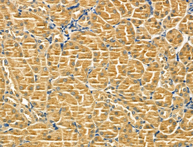 TSC1 Antibody in Immunohistochemistry (Paraffin) (IHC (P))