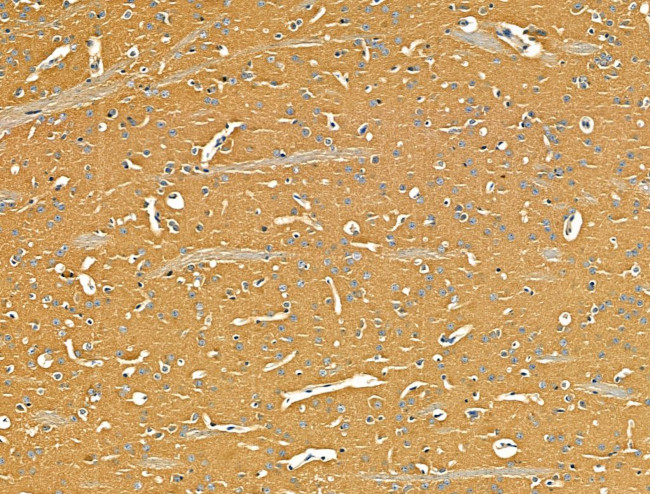 TSC1 Antibody in Immunohistochemistry (Paraffin) (IHC (P))