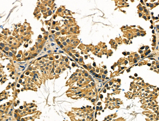 TSC1 Antibody in Immunohistochemistry (Paraffin) (IHC (P))