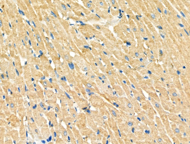 TSC1 Antibody in Immunohistochemistry (Paraffin) (IHC (P))