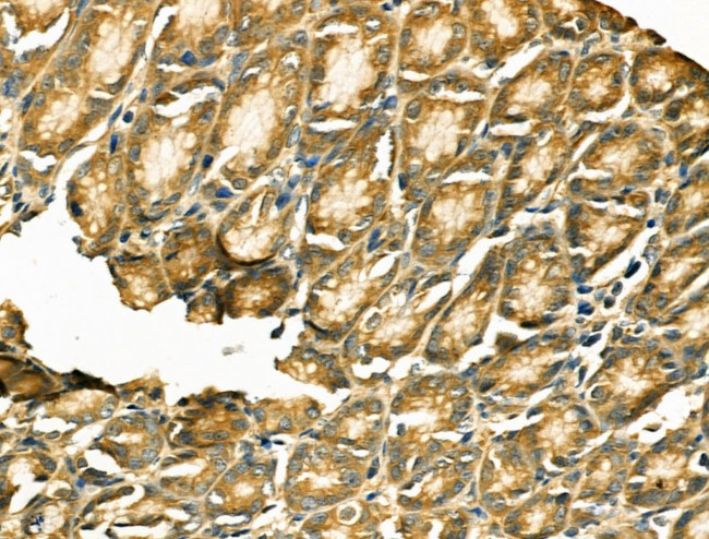 TSC1 Antibody in Immunohistochemistry (Paraffin) (IHC (P))