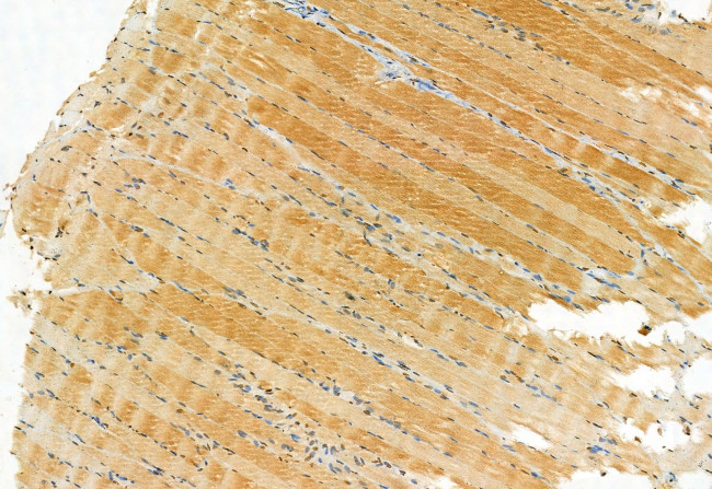 TSG101 Antibody in Immunohistochemistry (Paraffin) (IHC (P))