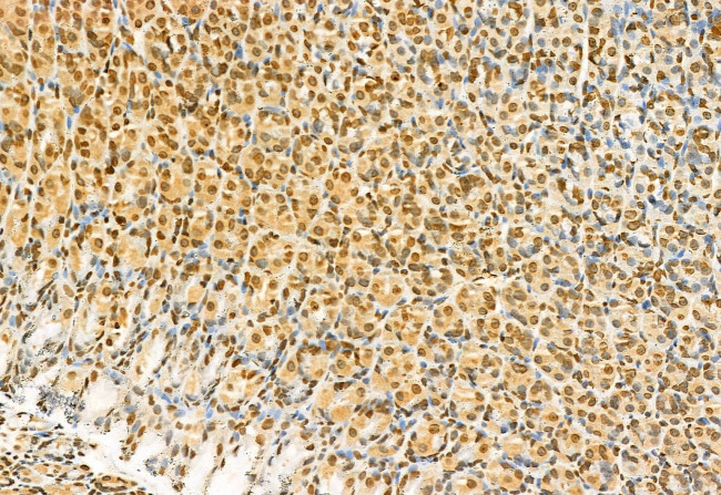 TSG101 Antibody in Immunohistochemistry (Paraffin) (IHC (P))