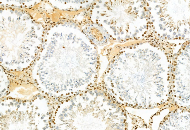 TSG101 Antibody in Immunohistochemistry (Paraffin) (IHC (P))